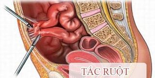 tác hại khi ăn nhiều rau 1